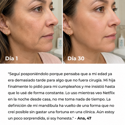 Escultor facial LED 7 en 1 | TersiaSkin