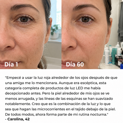 Escultor facial LED 7 en 1 | TersiaSkin